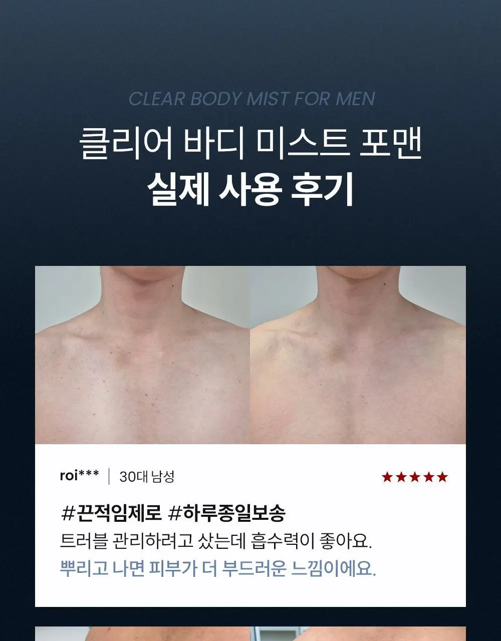 [등드름/체취케어] 낫포유 지성피부전용 등드름/가드름 클리어 바디미스트 포맨 200ml 상세페이지 14